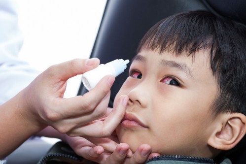 Pink Eye (Conjunctivitis) FAQ